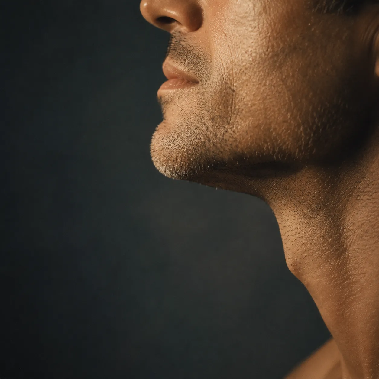 Implant mentonnier sur mesure positionné sur l'os du menton, Clinique esthétique Mozart à Nice