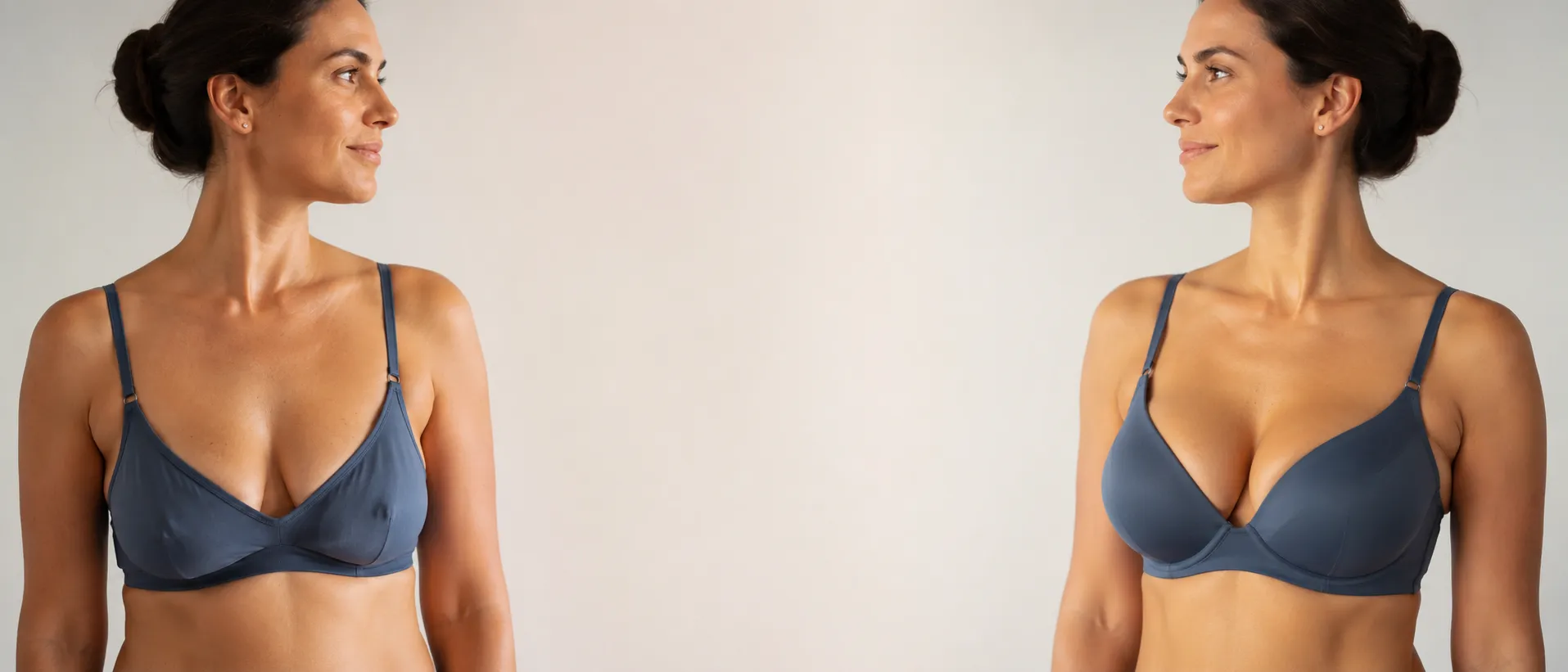 Avant et après un lifting des seins : la même femme face à elle-même, poitrine affaissée puis remontée au galbe redessiné